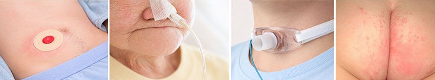 barrier film for skin