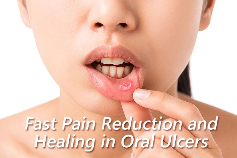 barrier film for skin