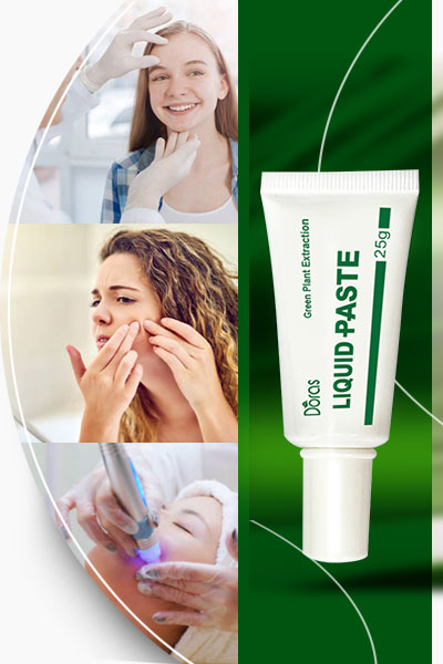 Acne Liquid Paste