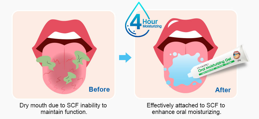口腔保湿ジェル